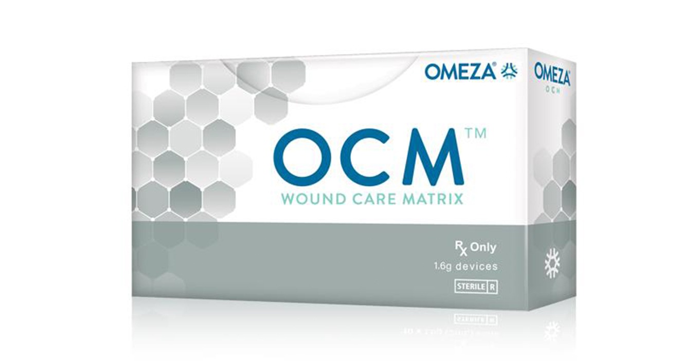 OCM