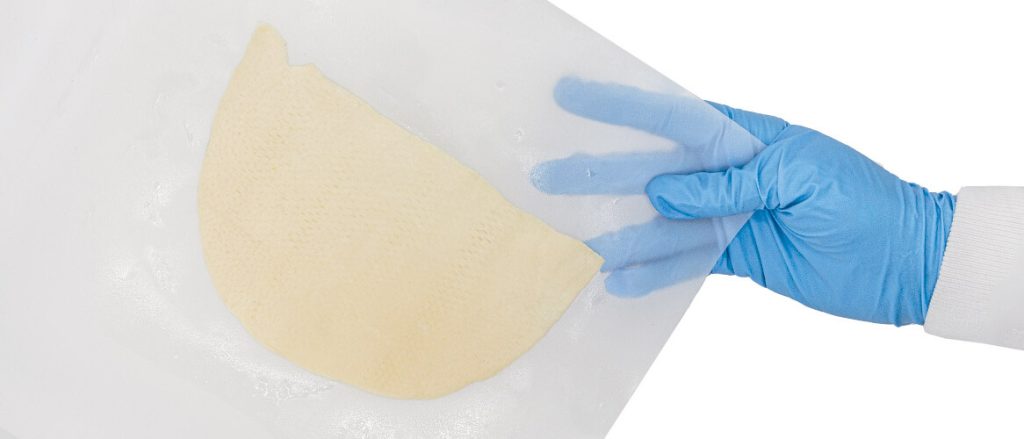AlloMend surgical matrix for soft tissue repair and cardiac surgery support