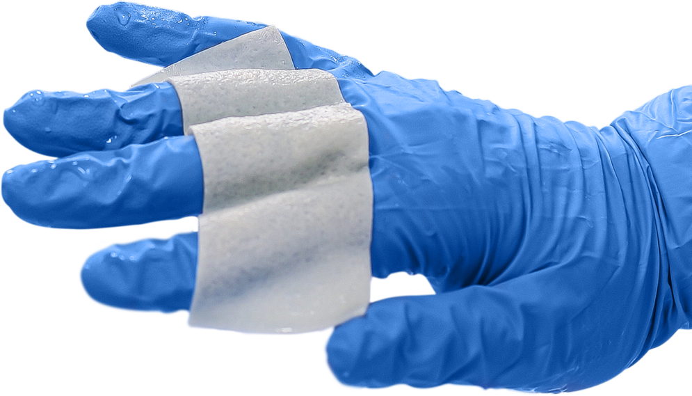 Cortiva human dermis allograft for breast reconstruction and hernia repair