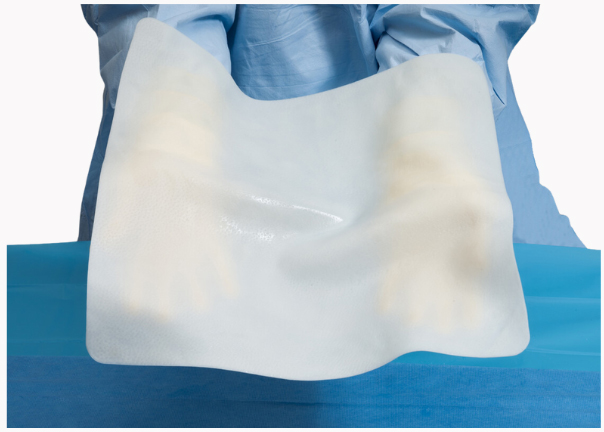 Fortiva surgical tissue matrix for breast reconstruction and soft tissue repair