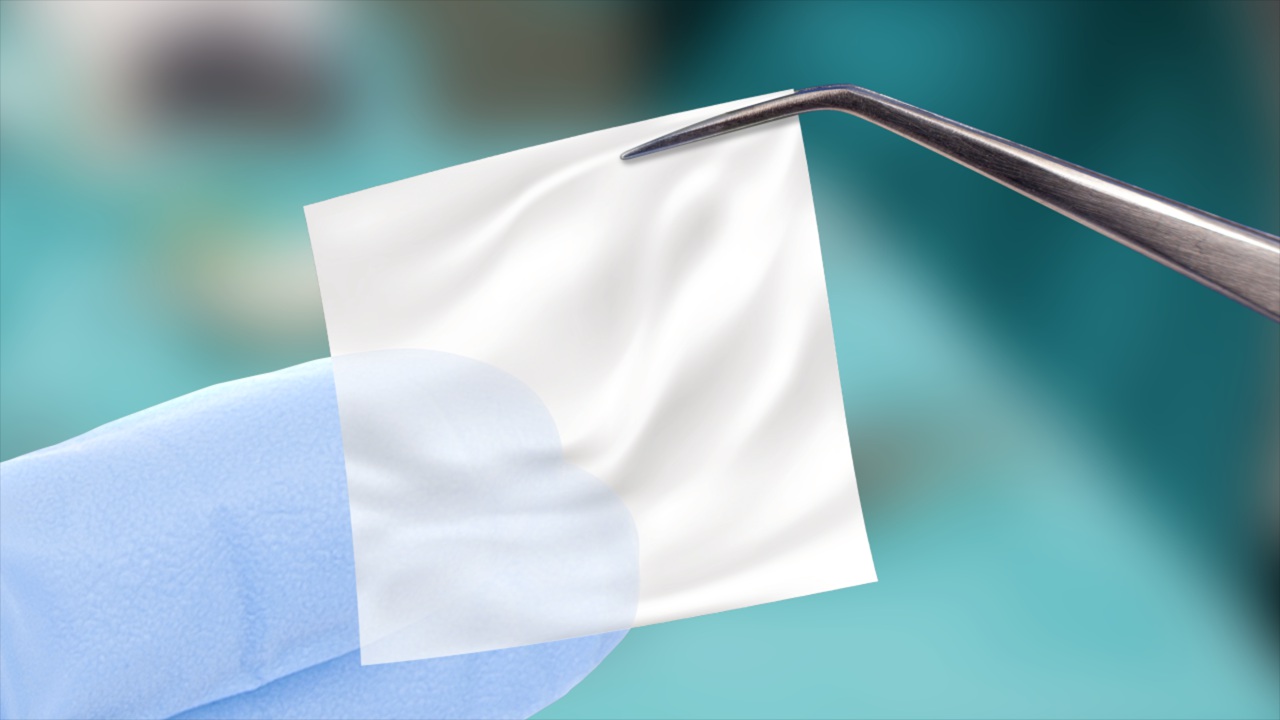Amniotic Tissue Surgery